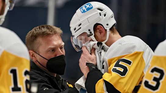 Matheson leaves game after taking puck to face taken in Washington (Penguins)